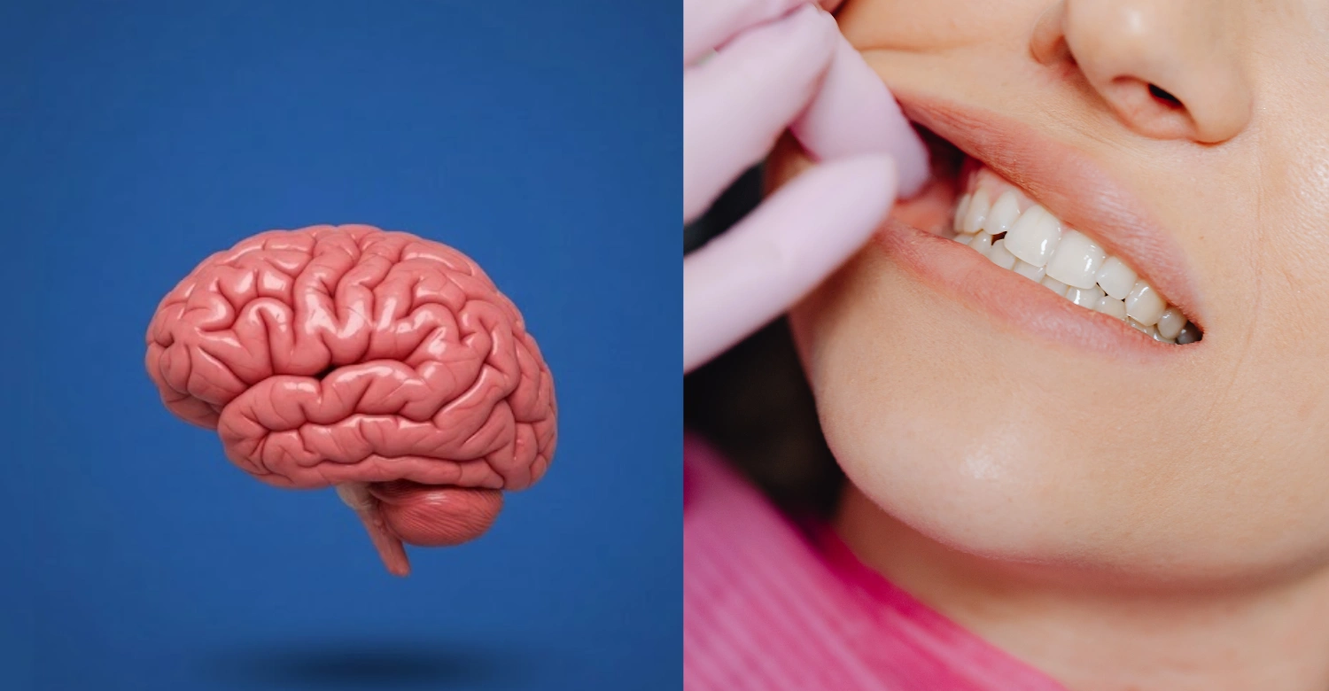 Alexander Disease and Oral Health 2